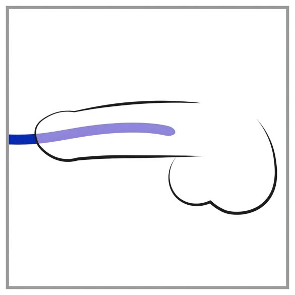 You2Toys - Dilator - sett med silikon dilatorer (3 stk)